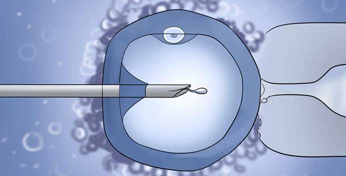 Expert Laparoscopic Surgeon in Worli